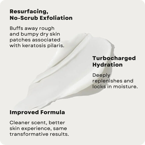 AmLactin KP Bumps Be Gone - Therapeutic Body Cream for Keratosis Pilaris - No-Scrub Exfoliator and Body Moisturizer for Dry Skin with 15% Lactic Acid AHA, 3 oz (Packaging May Vary)
